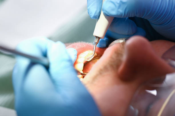 Best Emergency Treatment for Jaw Pain or Injury in Vandalia, IL