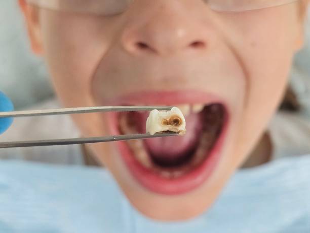 Best Walk-In Emergency Dental Services in Vandalia, IL