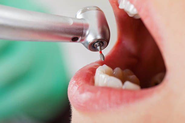 Best Emergency Treatment for Oral Infections in Vandalia, IL